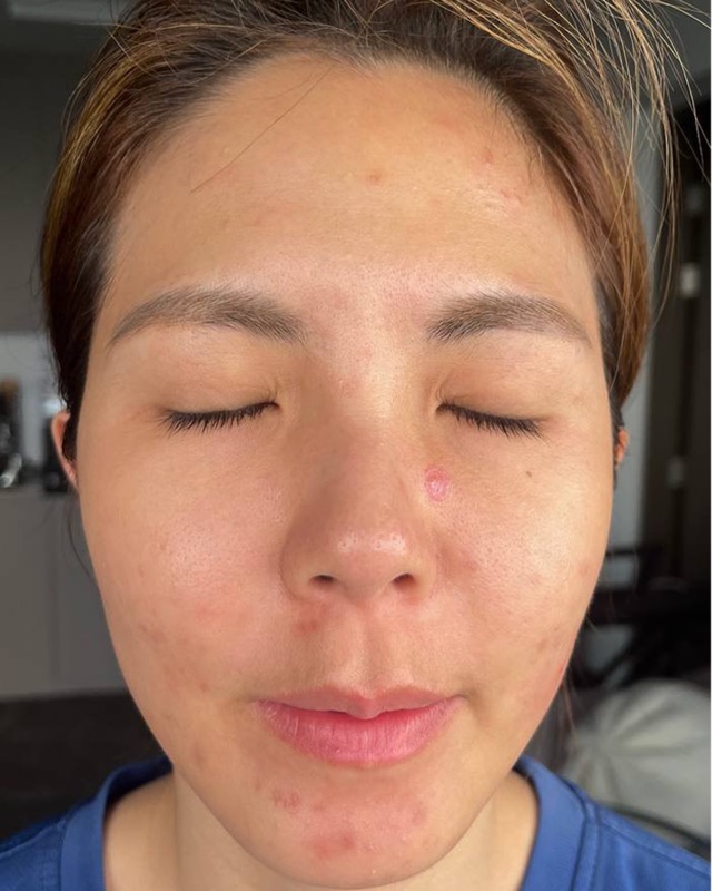 Bryna — Before