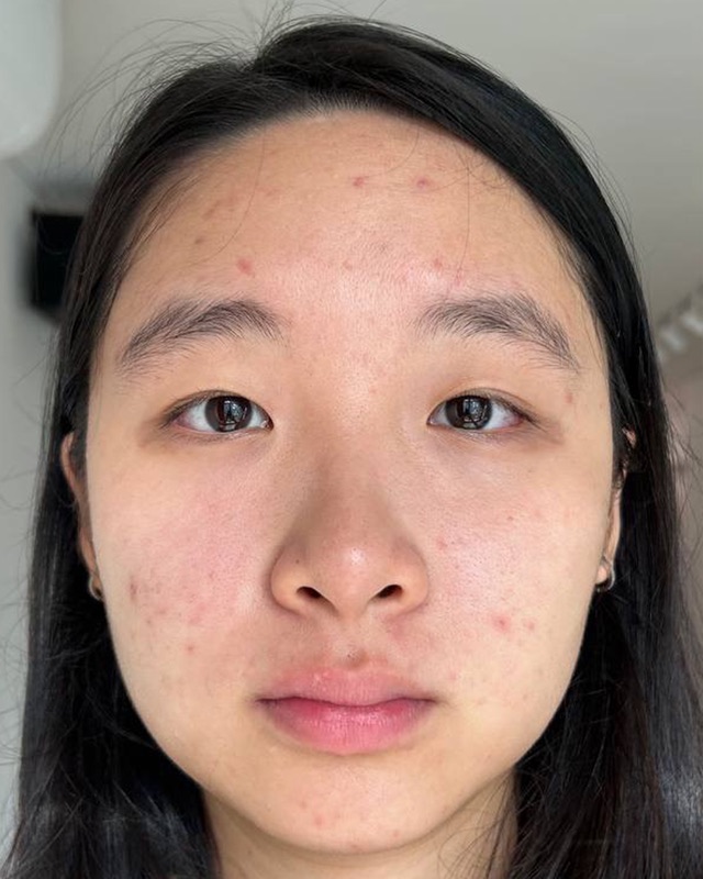 Chermaine Tan — Before