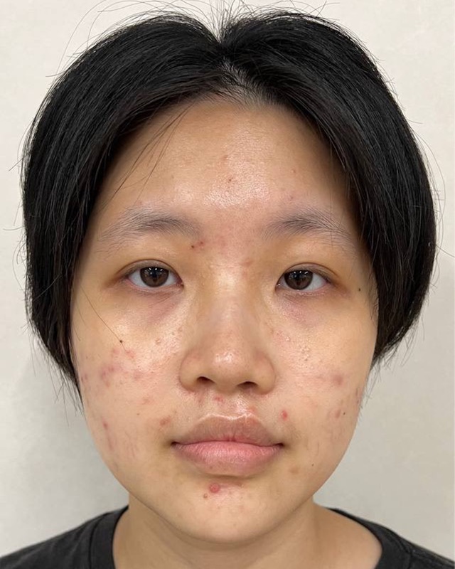 Larissa — Before